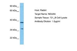 NDUFA10 Antibody, Novus Biologicals 100 &mu;L; Unconjugated:Antibodies,